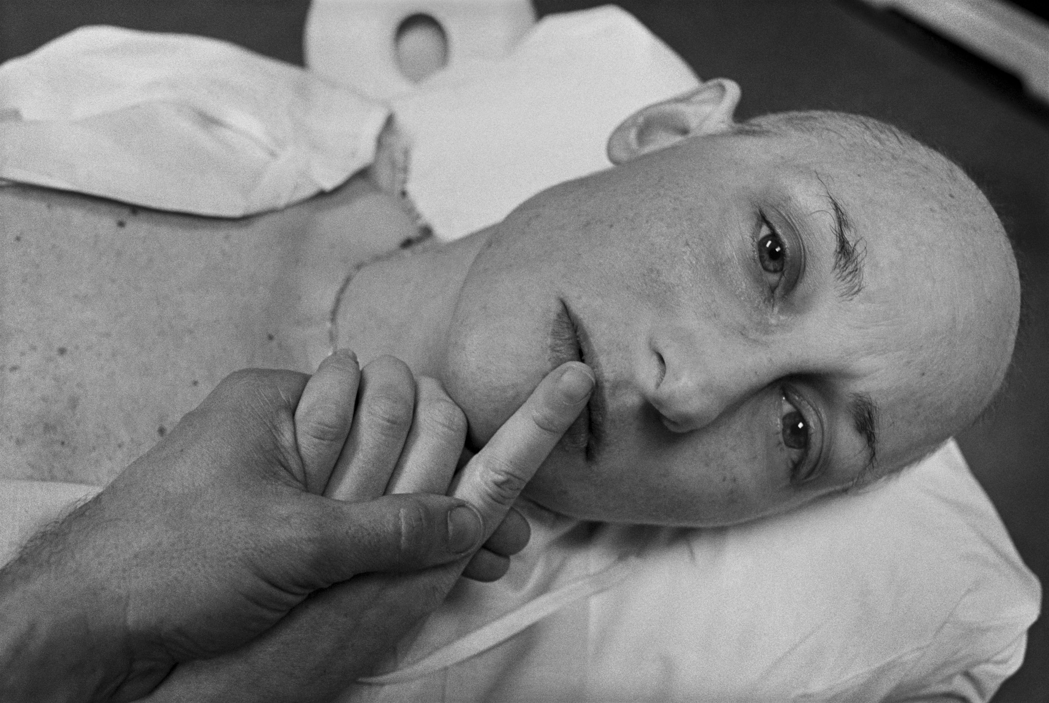 Final Treatment, by Eugene Richards