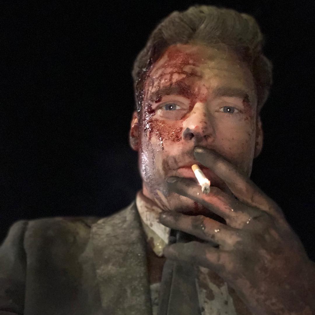 Richard Madden bloody face smoking cigarette