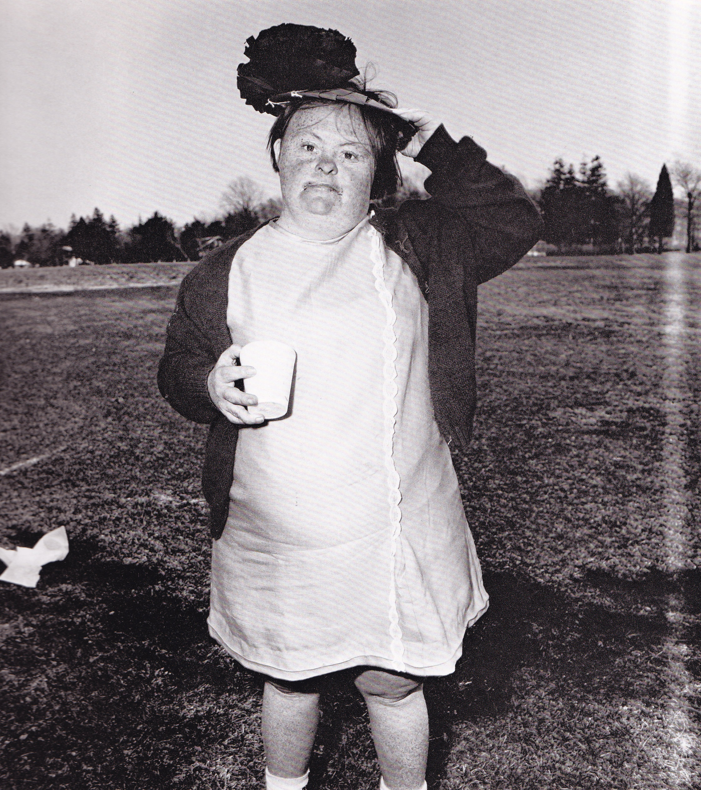 diane arbus photograph of a young woman with Downs Syndrome