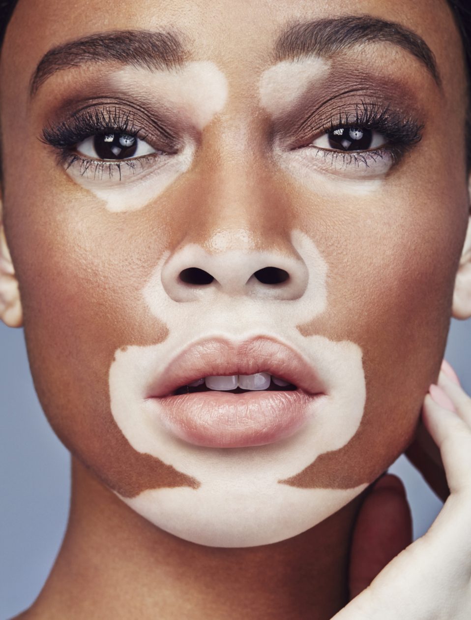 Model Winnie Harlow