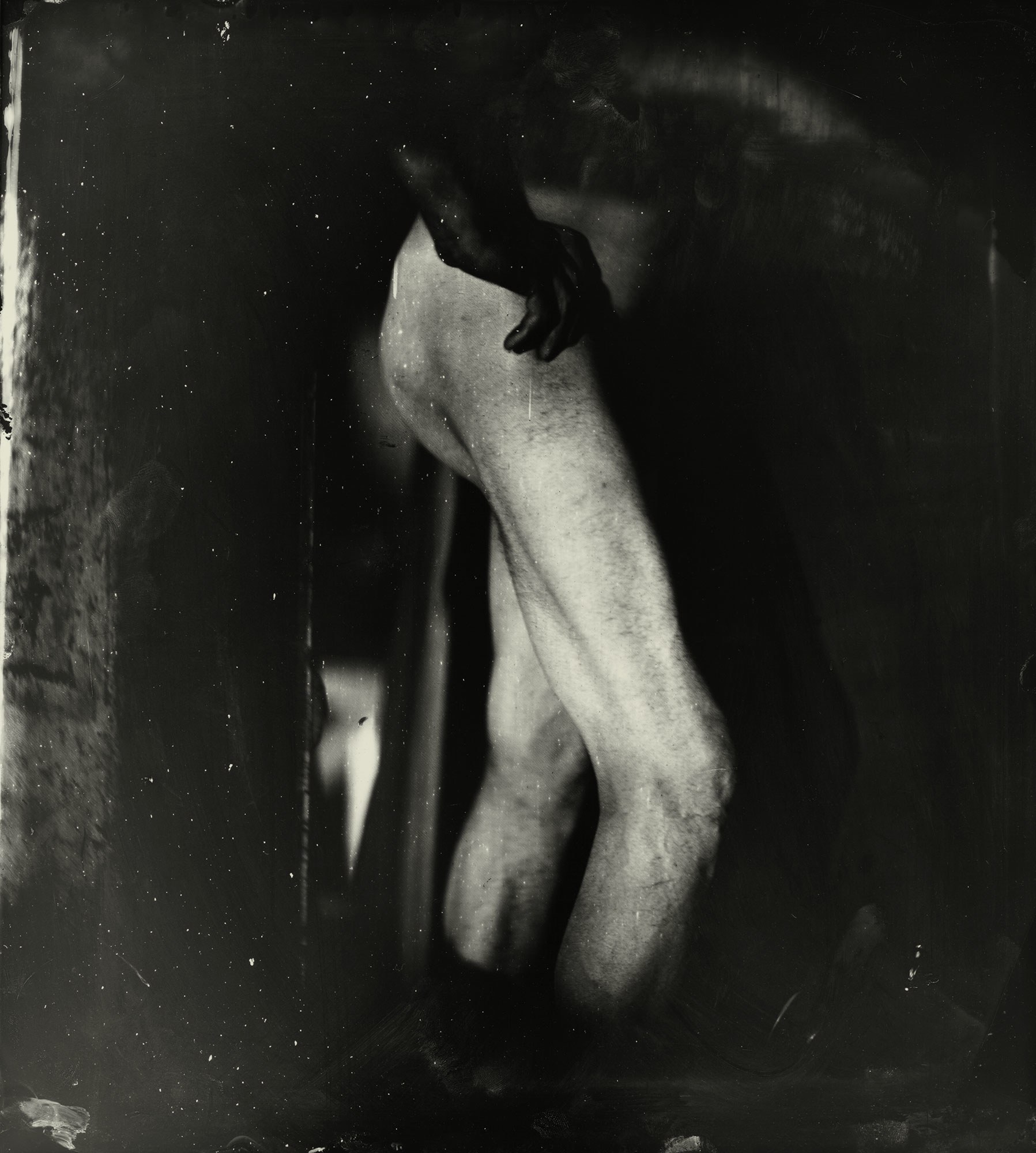 sally man photograph of an emaciated man's bare legs