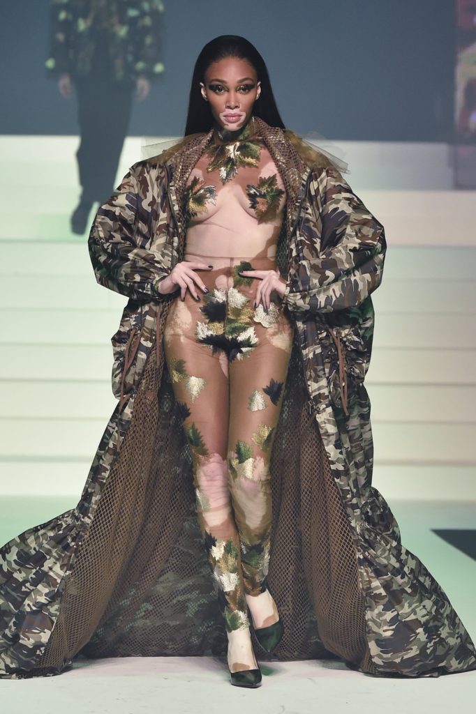 Winnie Harlow