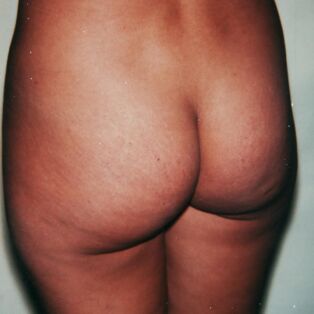 Sex Parts and Torso, 1977, Andy Warhol Photographs Fotogfafiska NYC and the Hedges Project