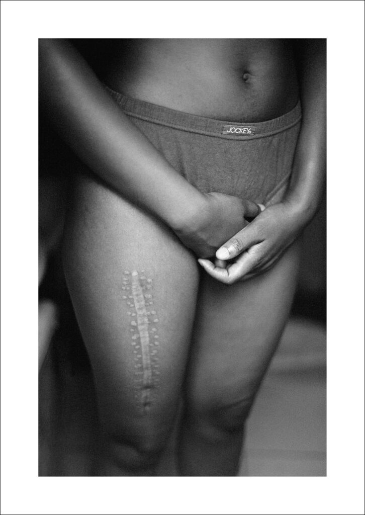 Zanele Muholi (b.1972) Aftermath 2004 Photograph, gelatin silver print on paper 600 x 395 mm Courtesy of the Artist and Stevenson, Cape Town/Johannesburg and Yancey Richardson, New York © Zanele Muholi