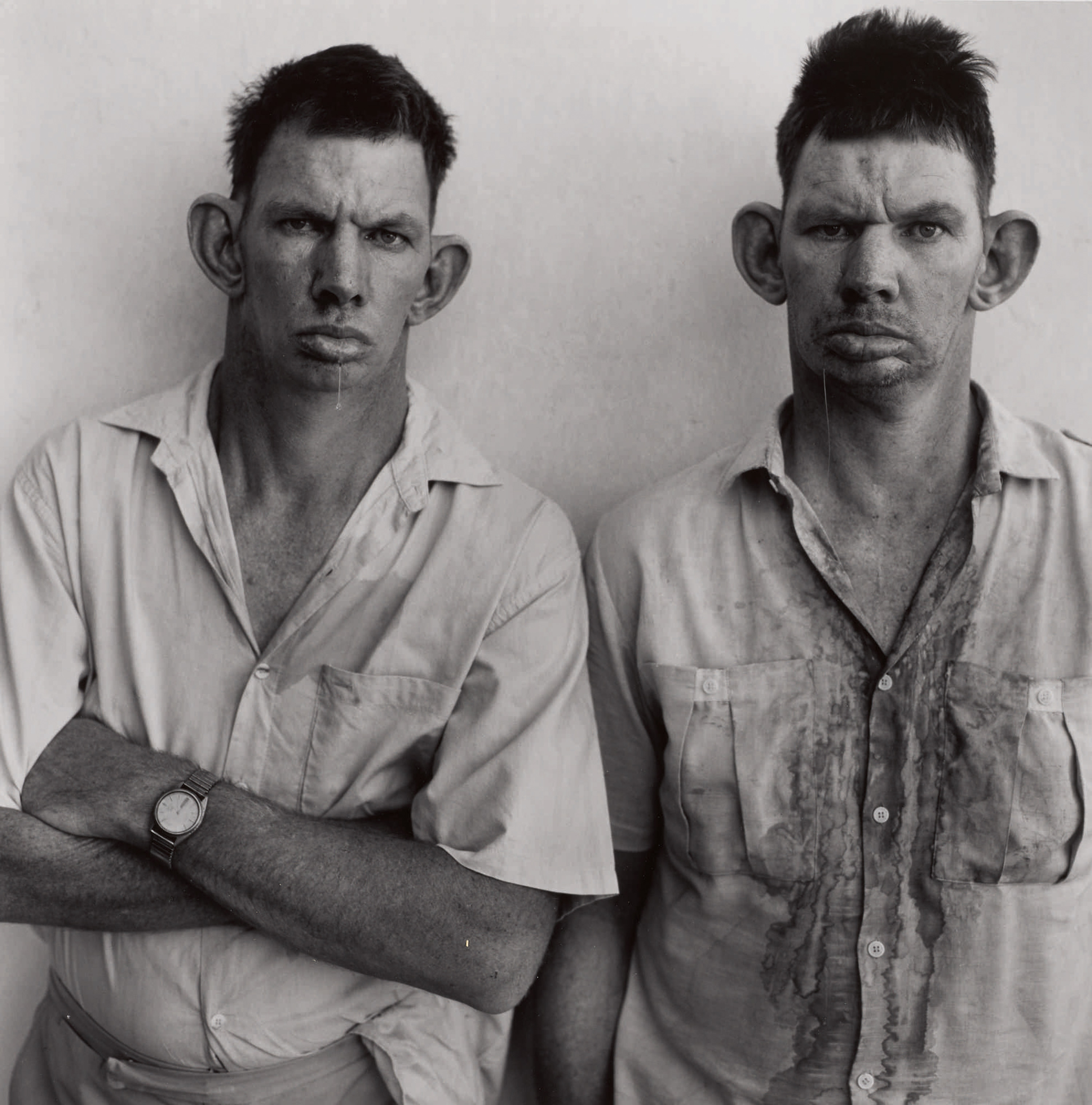 Roger Ballen, Casie and Dresie, Twins, Western Transvaal, South Africa, 1993, printed later