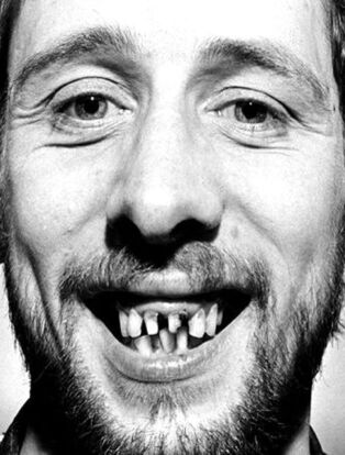shane macgowan the pogues